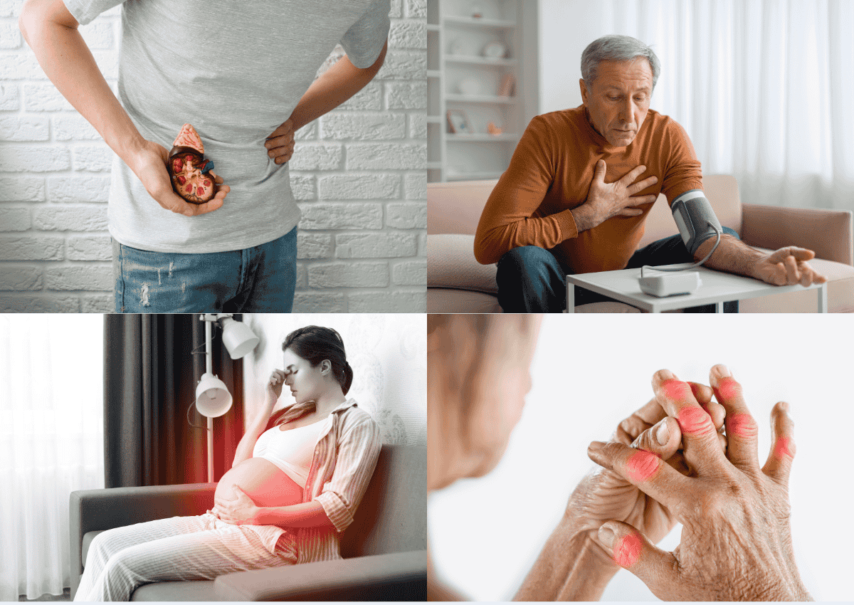 Ăn mắm tép có tốt không và những ai không nên ăn? 3 Những ai không nên ăn mắm tép